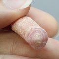 Rhodochrosite Stalagmite Stem ~24mm